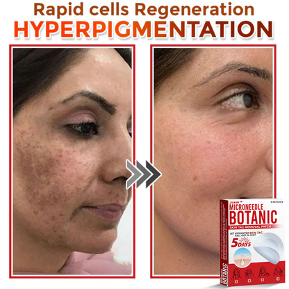 Juxek™ Removal Patch