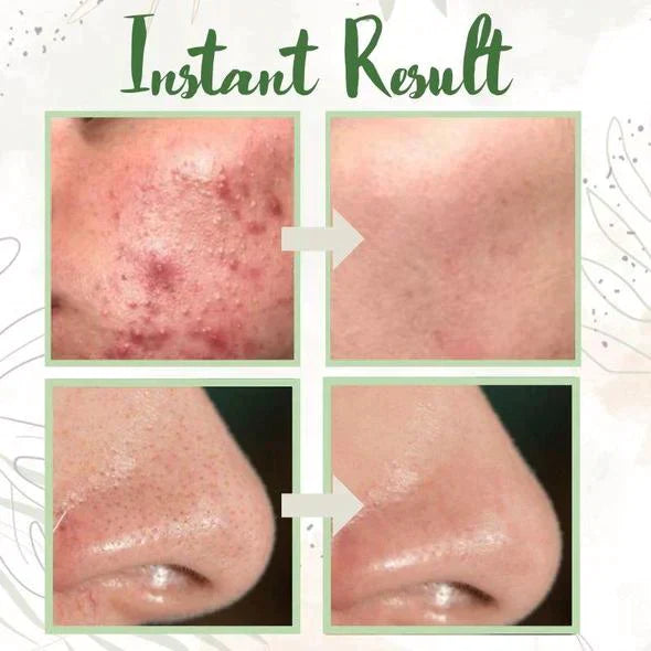 Final Sale - Green Tea Deep Cleanse Mask - （Limited time discount 🔥 last day）