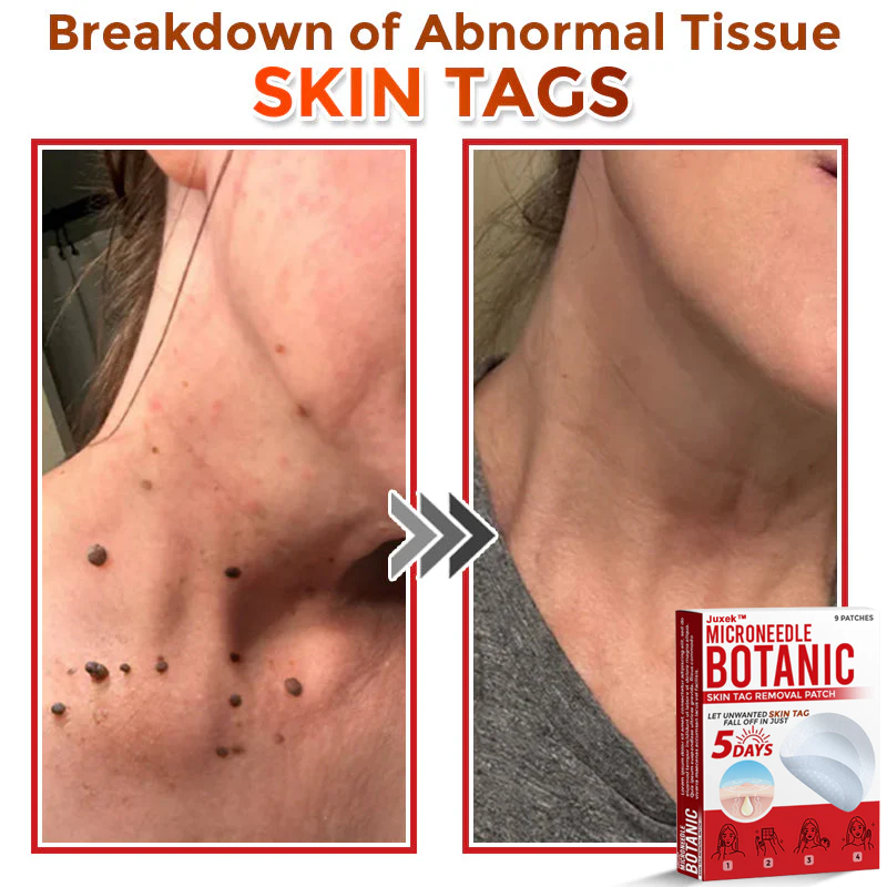 Juxek™ Removal Patch